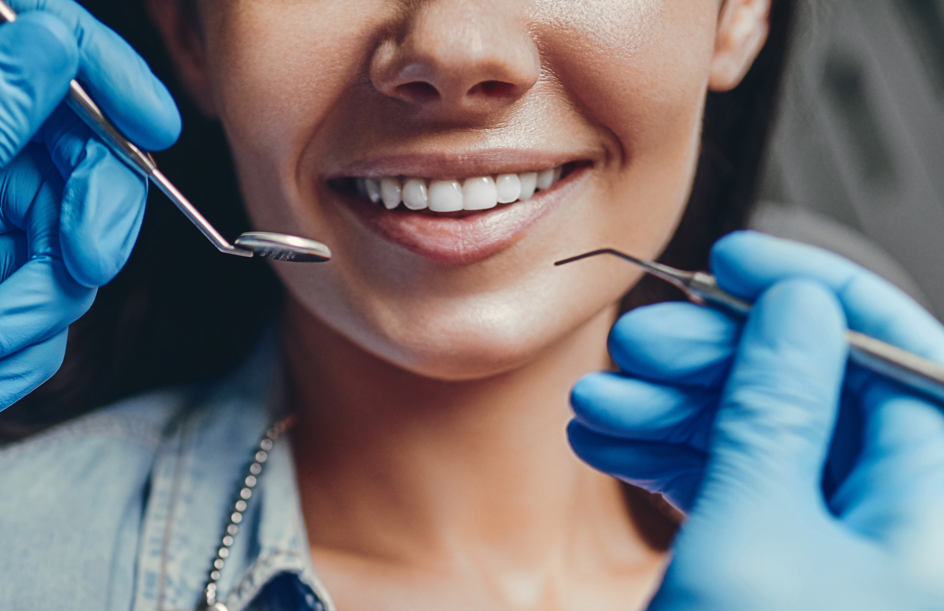 Bonding Συνθέτων ρητινών