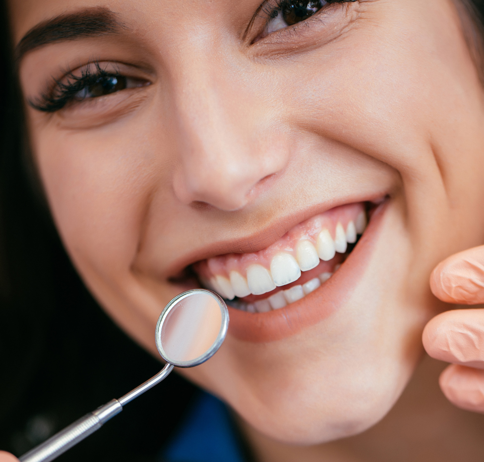 Όψεις ρητίνης