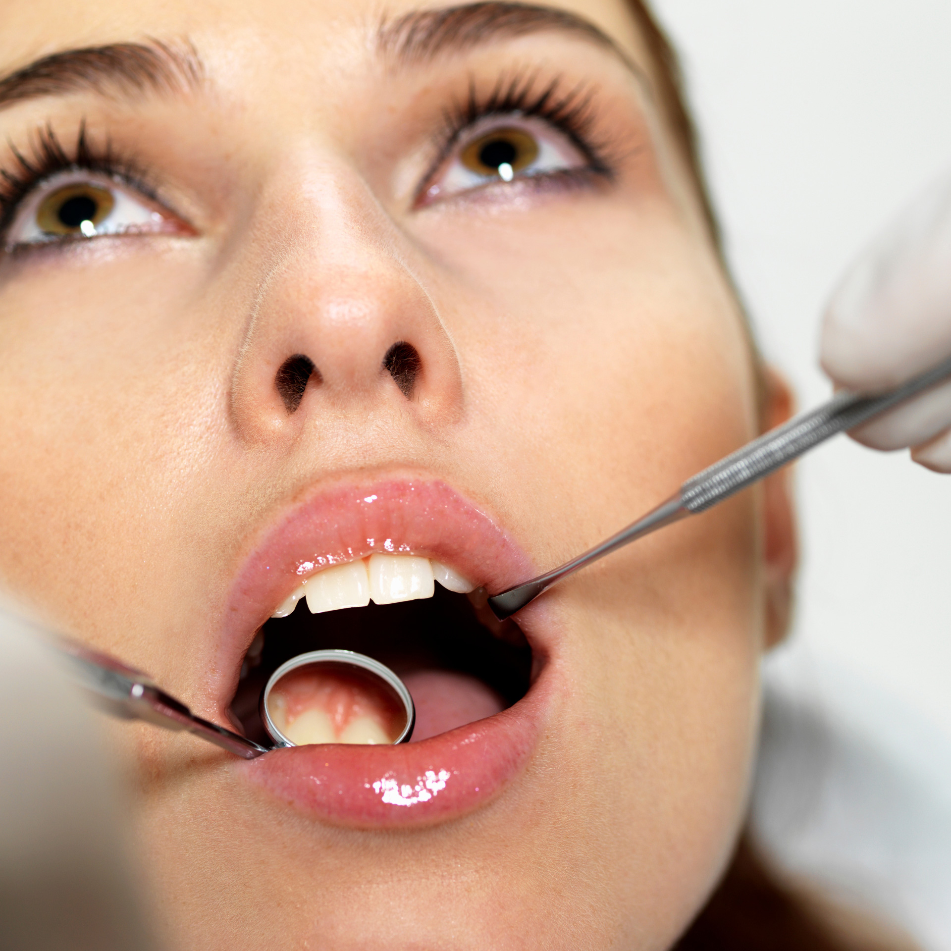 Ολοκεραμικές στεφάνες